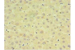 Immunohistochemistry of paraffin-embedded human liver tissue using ABIN7149254 at dilution of 1:100 (CYP2J2 Antikörper  (AA 328-502))