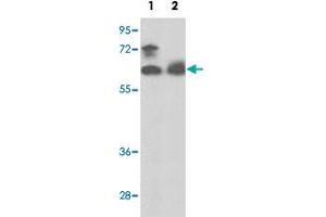 Western blot analysis of PANK1 polyclonal antibody  in MCF-7 cell line (Lane 1) and mouse spleen tissue lysates (Lane 2)(35 ug/lane).