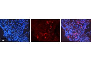 Immunohistochemistry (IHC) image for anti-Cyclin A2 (CCNA2) (C-Term) antibody (ABIN2779289)