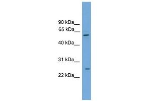 WB Suggested Anti-POT1 Antibody Titration: 0. (POT1 Antikörper  (Middle Region))