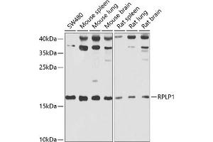 Western blot analysis of extracts of various cell lines, using RPLP1 antibody (ABIN6129657, ABIN6147166, ABIN6147167 and ABIN6222445) at 1:1000 dilution. (RPLP1 Antikörper  (AA 1-114))