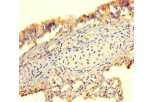Immunohistochemistry (IHC) image for anti-Bone Morphogenetic Protein 4 (BMP4) (AA 303-408) antibody (ABIN7145692)