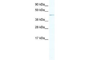 WB Suggested Anti-ARX Antibody Titration:  2. (Arx Antikörper  (Middle Region))