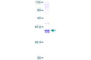 Image no. 1 for FOS-Like Antigen 2 (FOSL2) (AA 1-122) protein (GST tag) (ABIN1354316) (FOSL2 Protein (AA 1-122) (GST tag))