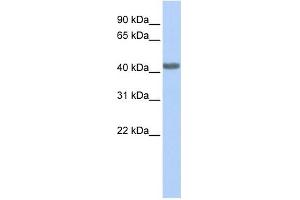 CCR2 antibody used at 1 ug/ml to detect target protein. (CCR2 Antikörper)