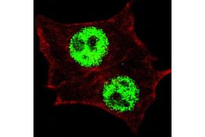 Fluorescent confocal image of HeLa cells stained with (ABIN390035 and ABIN2839785) Phospho-KLF4- antibody. (KLF4 Antikörper  (pSer254))