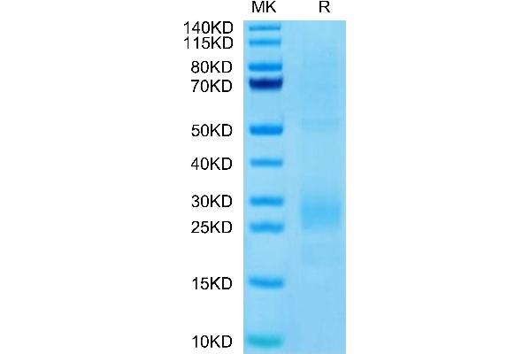 MIF Protein (AA 2-115) (His tag)