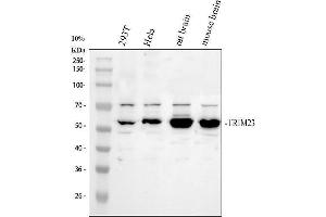 Western blot analysis of TRIM23 using anti-TRIM23 antibody (ABIN7825981).
