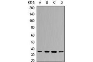 Western blot analysis of PPX expression in MCF7 (A), NIH3T3 (B), mouse testis (C), mouse spleen (D) whole cell lysates. (PPP4C Antikörper)