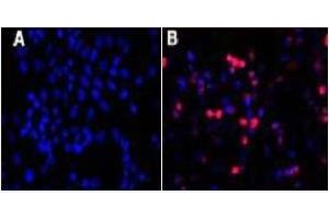Immunofluorescence (IF) image for anti-His Tag antibody (ABIN1105141)