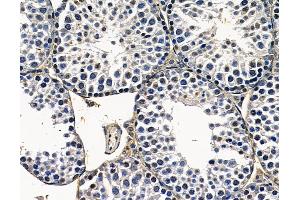 ABIN7097028 and ABIN7101095 at 1/100 staining mouse testis tissue by IHC-P. (DHX57 Antikörper)