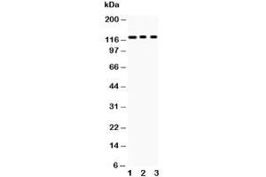 Western blot testing of PLD1 antibody and Lane 1:  mouse heart (PLD1 Antikörper  (AA 1-330))