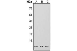 Western blot analysis of S100-A7 expression in HEK293T (A), NS-1 (B), H9C2 (C) whole cell lysates. (S100A7 Antikörper  (Center))