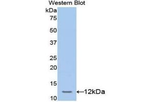 Western blot analysis of the recombinant protein. (TCF20 Antikörper  (AA 125-213))