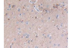 Detection of GFAP in Human Cerebrum Tissue using Polyclonal Antibody to Glial Fibrillary Acidic Protein (GFAP)