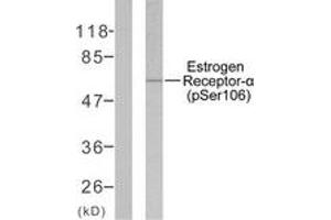 Western blot analysis of extracts from MCF7 cells, using Estrogen Receptor-alpha (Phospho-Ser106) Antibody. (Estrogen Receptor alpha Antikörper  (pSer106))