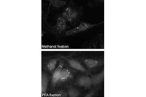 Immunofluorescence staining of SQSTM1 polyclonal antibody  on Methanol-fixed and PFA fixed HeLa cells. (SQSTM1 Antikörper  (C-Term))