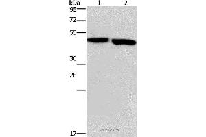 Western blot analysis of Mouse stomach and brain tissue, using CLUAP1 Polyclonal Antibody at dilution of 1:500 (CLUAP1 Antikörper)