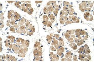 Immunohistochemical staining (Formalin-fixed paraffin-embedded sections) of human muscle with KLHL31 polyclonal antibody . (KLHL31 Antikörper  (AA 501-550))