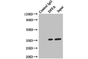 Immunoprecipitating DFFA in Hela whole cell lysate Lane 1: Rabbit control IgG instead of (1 μg) instead of ABIN7150176 in Hela whole cell lysate.