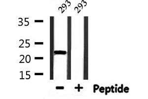 Western Blotting (WB) image for anti-TEA Domain Family Member 1 (SV40 Transcriptional Enhancer Factor) (TEAD1) (Internal Region) antibody (ABIN6257778)