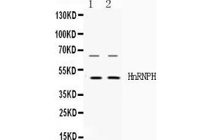 Western blot analysis of HnRNP H expression in HELA whole cell lysates ( Lane 1) and HEPG2 whole cell lysates ( Lane 2).