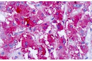 Anti-CELSR1 antibody IHC staining of human adrenal.