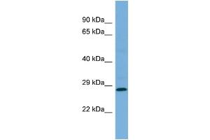 Western Blotting (WB) image for anti-Mediator Complex Subunit 19 (MED19) (Middle Region) antibody (ABIN2786282) (MED19 Antikörper  (Middle Region))