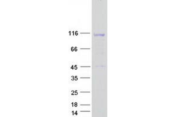 LEMD3 Protein (Transcript Variant 2) (Myc-DYKDDDDK Tag)