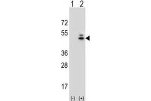 Western Blotting (WB) image for anti-Actin, gamma 1 (ACTG1) antibody (ABIN3002670) (Actin, gamma 1 Antikörper)