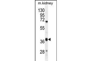 DUS4L Antibody (Center) (ABIN654982 and ABIN2844622) western blot analysis in mouse kidney tissue lysates (35 μg/lane). (DUS4L Antikörper  (AA 141-170))