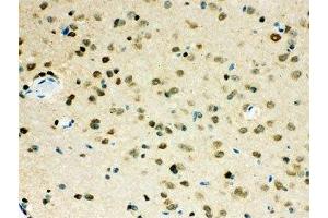 IHC-P testing of VCP antibody and mouse brain tissue