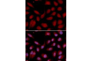 Immunofluorescence analysis of U2OS cell using CD3E antibody. (CD3 epsilon Antikörper  (AA 25-207))