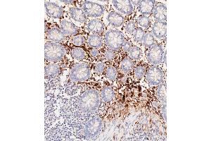 Immunohistochemical analysis of paraffin-embedded Human colon tissue using C performed on the Leica® BOND RXm. (Haptoglobin Antikörper  (Center))