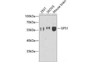 Western blot analysis of extracts of various cell lines using GPS1 Polyclonal Antibody at dilution of 1:1000. (GPS1 Antikörper)
