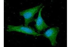 ICC/IF analysis of GMFB in HeLa cells line, stained with DAPI (Blue) for nucleus staining and monoclonal anti-human GMFB antibody (1:100) with goat anti-mouse IgG-Alexa fluor 488 conjugate (Green). (GMFB Antikörper  (AA 1-142))