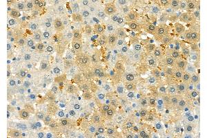 ABIN6261280 and ABIN6279617 at 1/100 staining Rat liver tissue by IHC-P. (Non-Syndromic Hearing Impairment Protein 5 (GSDME) (C-Term) Antikörper)