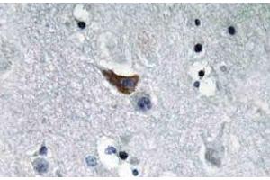 Immunohistochemistry (IHC) analyzes of GluR1 antibody in paraffin-embedded human brain tissue. (Glutamate Receptor 1 Antikörper)