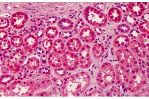 Human Kidney: Formalin-Fixed, Paraffin-Embedded (FFPE) (LGI3 Antikörper  (Internal Region))