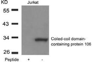 Western blot analysis of extracts from Jurkat cells using Coiled-coil domain-containing protein 106and the same antibody preincubated with blocking peptide. (CCDC106 Antikörper  (Coiled coil domain))