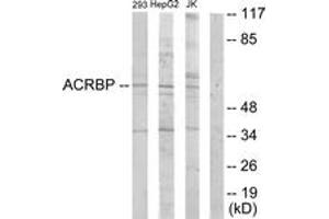 Western blot analysis of extracts from HepG2/Jurkat/293 cells, using ACRBP Antibody. (ACRBP Antikörper  (AA 181-230))