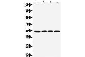 Anti-muscarinic Acetylcholine Receptor 1 antibody, Western blotting Lane 1: Rat Brain Tissue Lysate Lane 2: Mouse Brain Tissue Lysate Lane 3: U87 Cell Lysate Lane 4: SHG Cell Lysate Lane 5: NEURO Cell Lysate Lane 6: HELA Cell Lys (CHRM1 Antikörper  (C-Term))