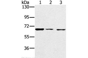 Western Blot analysis of A172, hela and hepg2 cell using IGF2BP3 Polyclonal Antibody at dilution of 1:200 (IGF2BP3 Antikörper)