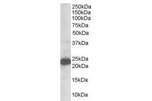 Image no. 1 for anti-Stathmin-Like 2 (STMN2) (N-Term) antibody (ABIN374200) (STMN2 Antikörper  (N-Term))