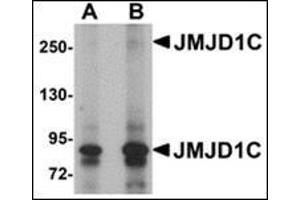 Western blot analysis of JMJD1C in human liver tissue lysate with this product at (A) 1 and (B) 2 μg/ml. (JMJD1C Antikörper  (N-Term))