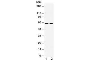 Western blot testing of 1) rat testis and 2) human MCF7 lysate with ACCN1 antibody at 0. (ACCN1 Antikörper  (AA 112-147))