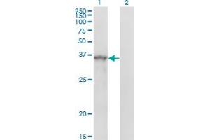 Western Blot analysis of SPRY1 expression in transfected 293T cell line by SPRY1 monoclonal antibody (M01), clone 3H4. (SPRY1 Antikörper  (AA 1-110))