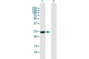 Western Blot analysis of NOG expression in transfected 293T cell line by NOG MaxPab polyclonal antibody. (NOG Antikörper  (AA 1-232))