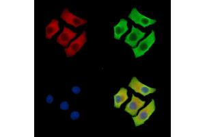 ABIN7095942 and ABIN7100004 staining Hela cells by IF/ICC. (LIMCH1 Antikörper)