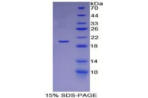 SDS-PAGE analysis of Rat ESM1 Protein. (ESM1 Protein)
